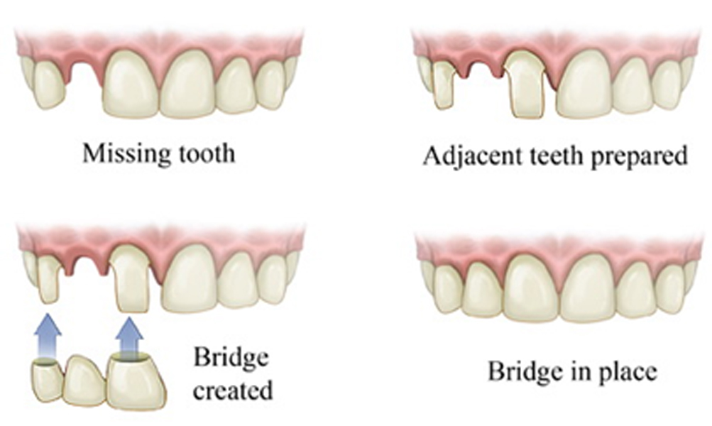 dental_hygienist